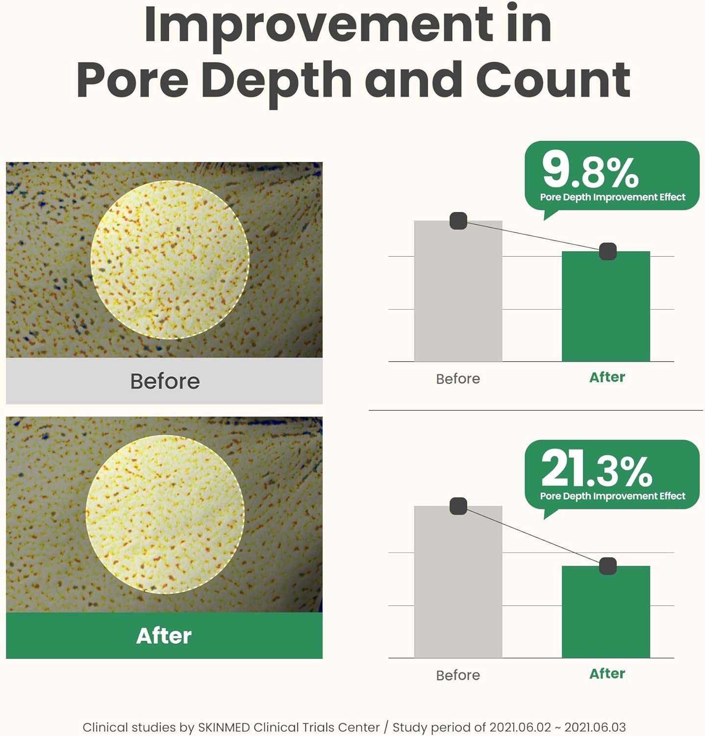 Axis-Y Mugwort Pore Clarifying Wash Off Pack 100 мл – корейска детокс маска с мъгворт за чисти и стегнати пори