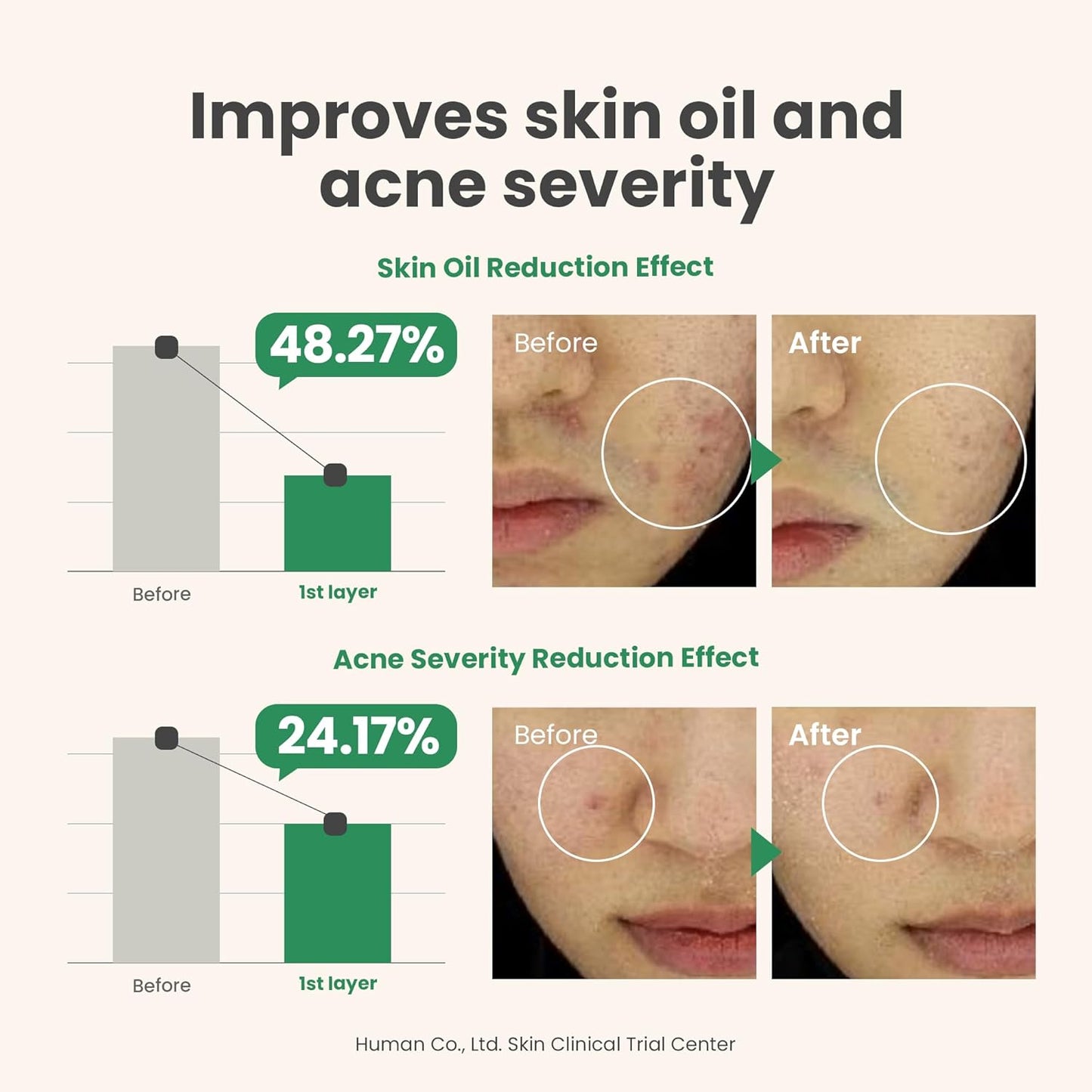 Axis-Y Sunday Morning Refreshing Cleansing Foam 120 мл – нежна почистваща пяна за лице за всяка кожа