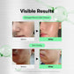 VT Cosmetics Reedle Shot 300 Microneedle Face Booster 10 × 2 мл – корейски микроиглен бустер за лице