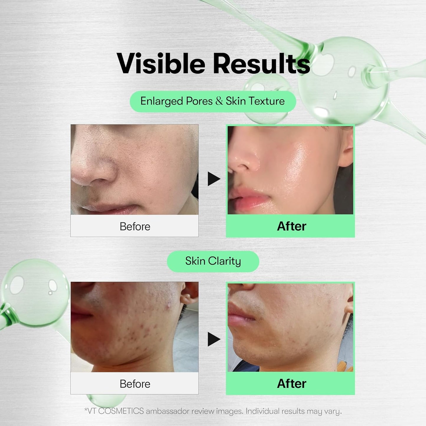 VT Cosmetics Reedle Shot 300 Microneedle Face Booster 10 × 2 мл – корейски микроиглен бустер за лице